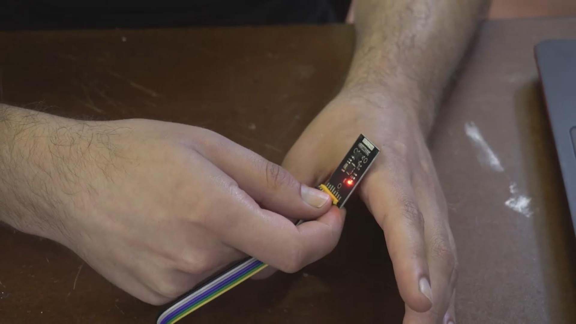 Türk Youtuber deri altına çip yerleştirdi! Bir çok elektronik cihazda kullanabiliyor