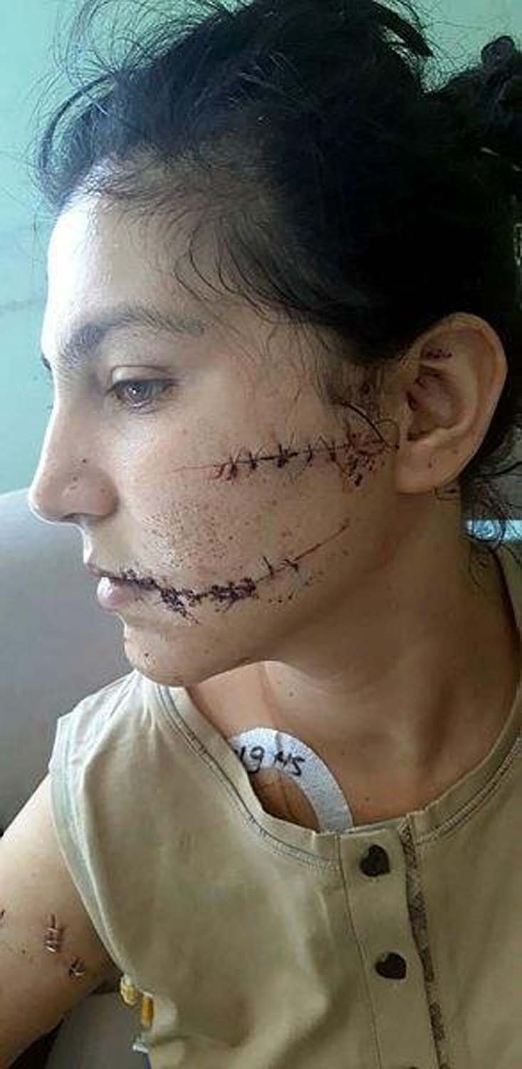 Kan donduran vahşet! Hayat arkadaşını 104 yerinden bıçakladı!