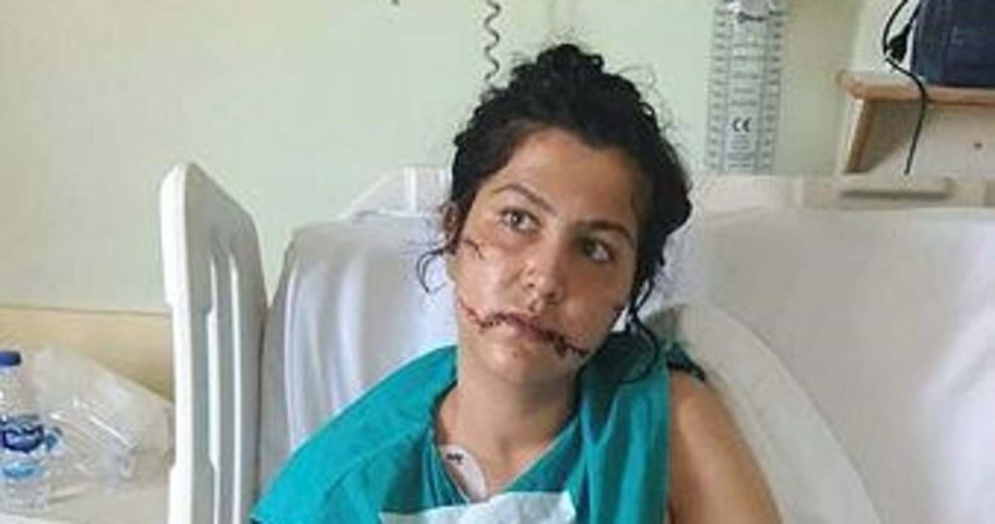 Kan donduran vahşet! Hayat arkadaşını 104 yerinden bıçakladı!