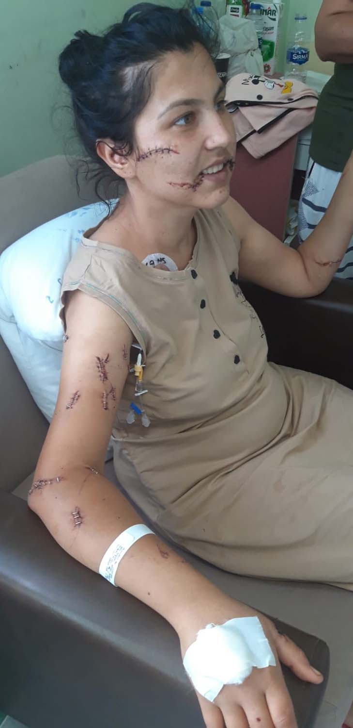 Kan donduran vahşet! Hayat arkadaşını 104 yerinden bıçakladı!