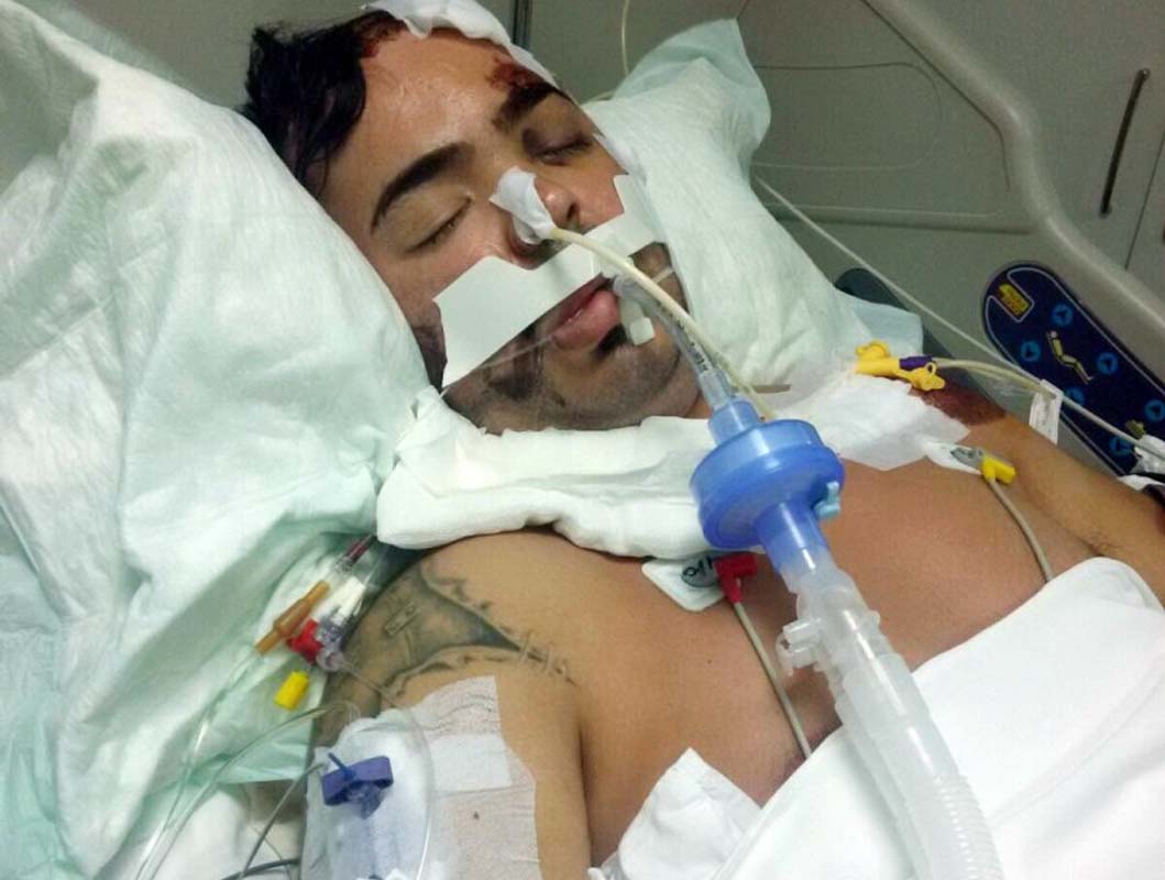 Doktorlar yürüyemez diyordu! 752 gün komada kalan adam şimdi koşmak için çaba sarf ediyor!