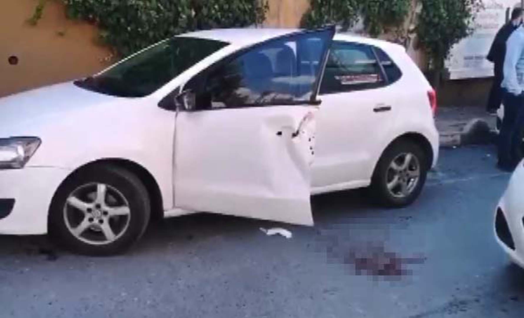 Doktor’un parmakları talihsiz kazada koptu; Parmaklarını alıp hastaneye koştu