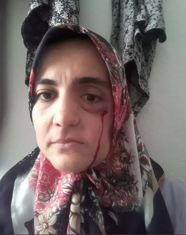 Ayşe Özdoğan kimdir? Nereli, kaç yaşında? Ayşe Özdoğan neden gündem oldu?