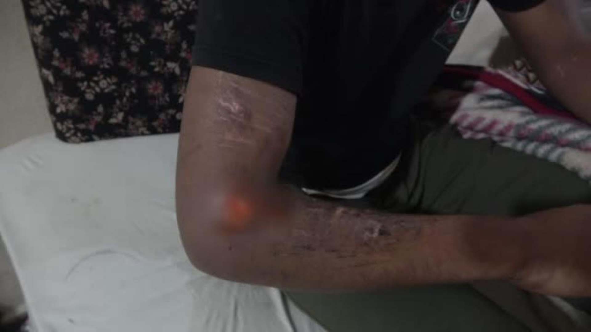 Avrupa umuduyla Yunanistan'a kaçan göçmenler günlerce işkence gördü! Hayatlarını Türk askeri kurtardı