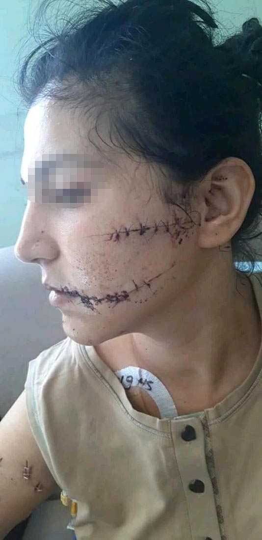 Cani Koca eşini 104 yerinden bıçaklamıştı! Kendini Uyuşturucu kullanıyordu, kendine zarar verdi sözleriyle savunmuştu! Gerçek ortaya çıktı!