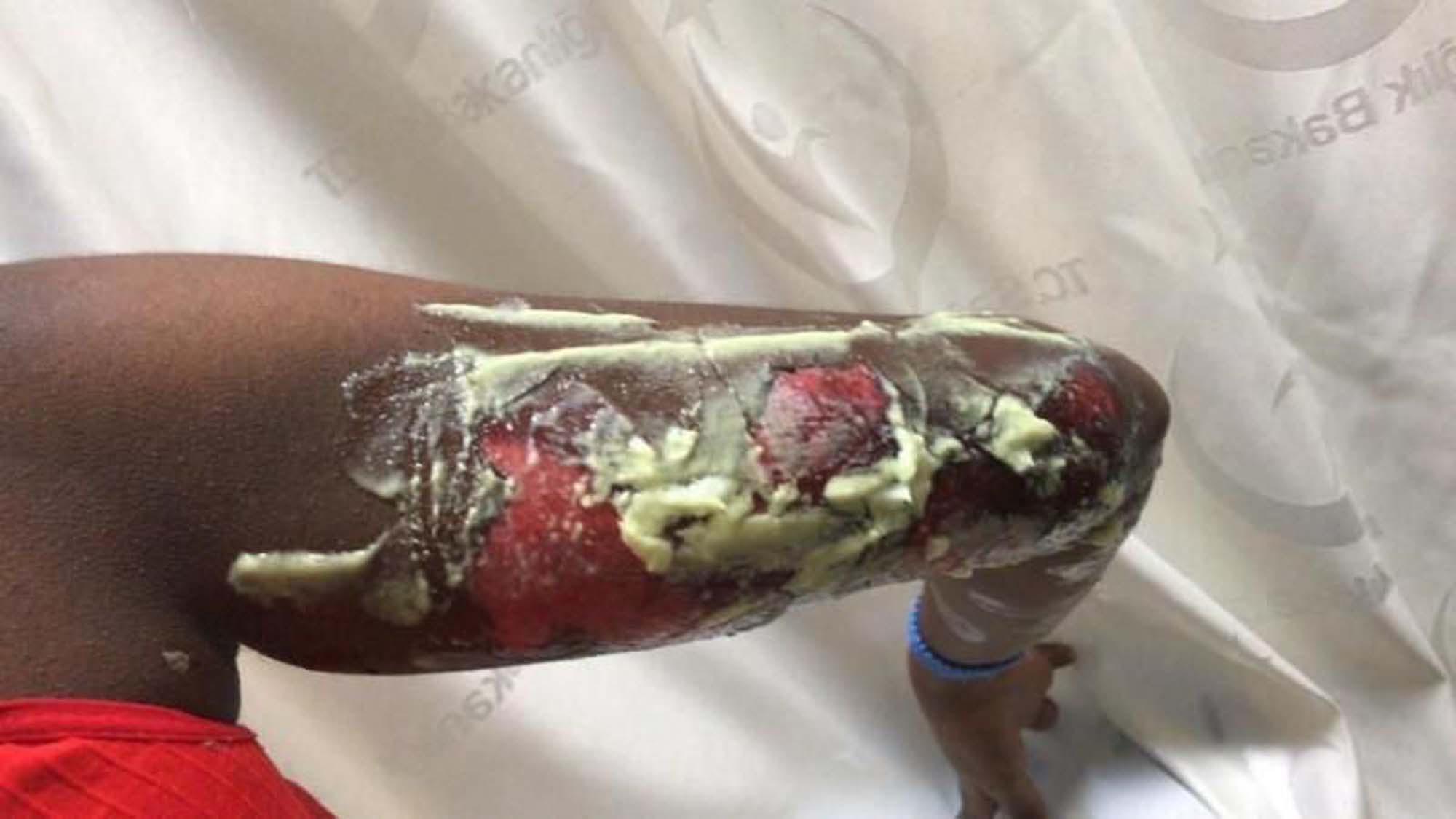 Vahşetin böylesi! Yunanistan, mültecileri diri diri yaktı!