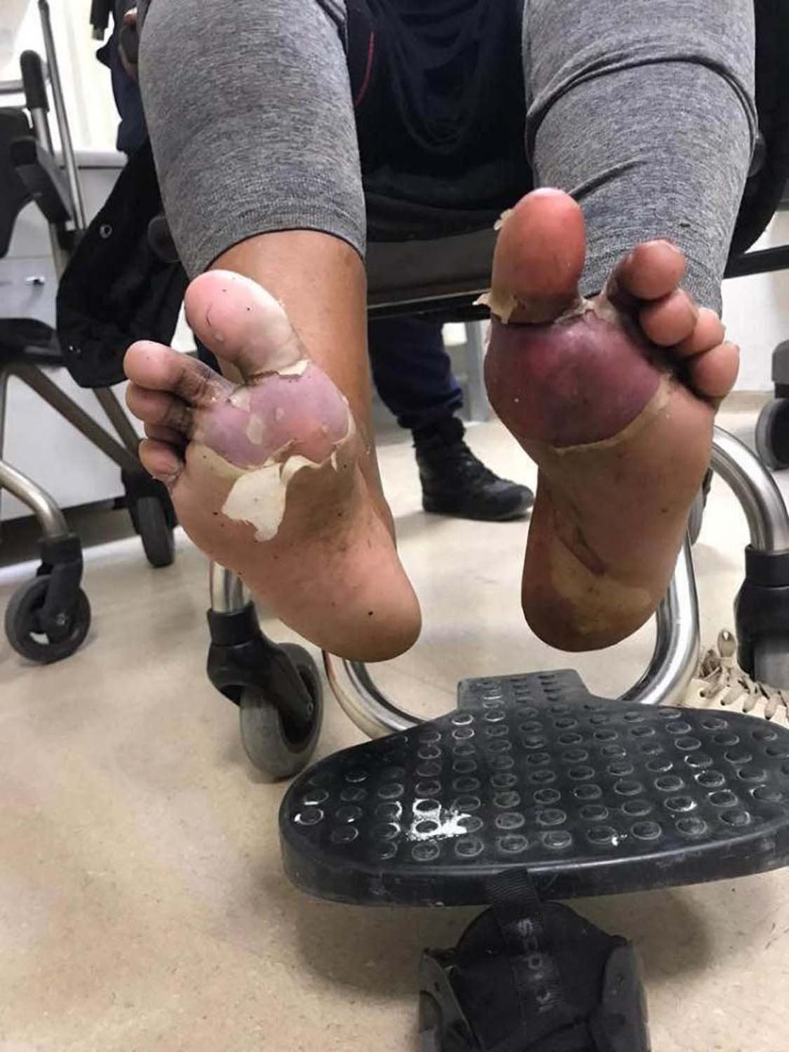 Vahşetin böylesi! Yunanistan, mültecileri diri diri yaktı!