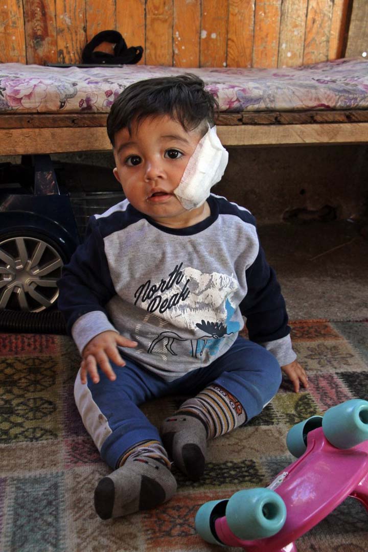 Pitbull dehşeti bu kez Antalya'da! 11 aylık çocuğun yanağı ve kulağını kopardı, babasını metrelerce sürükledi