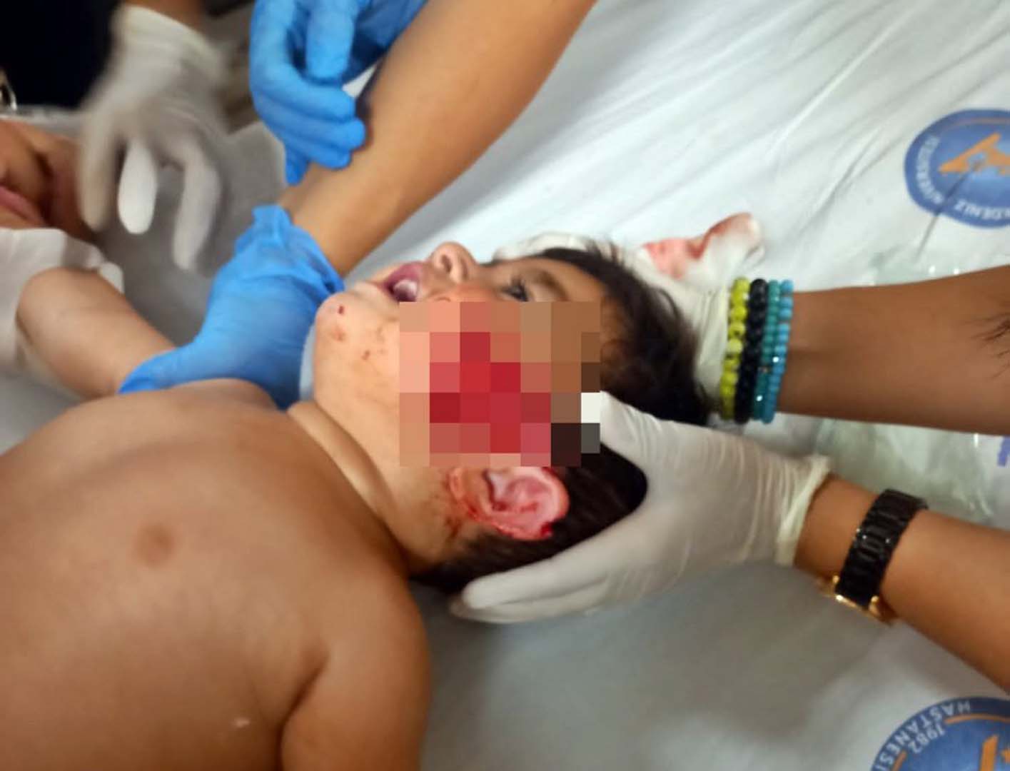 Pitbull dehşeti bu kez Antalya'da! 11 aylık çocuğun yanağı ve kulağını kopardı, babasını metrelerce sürükledi