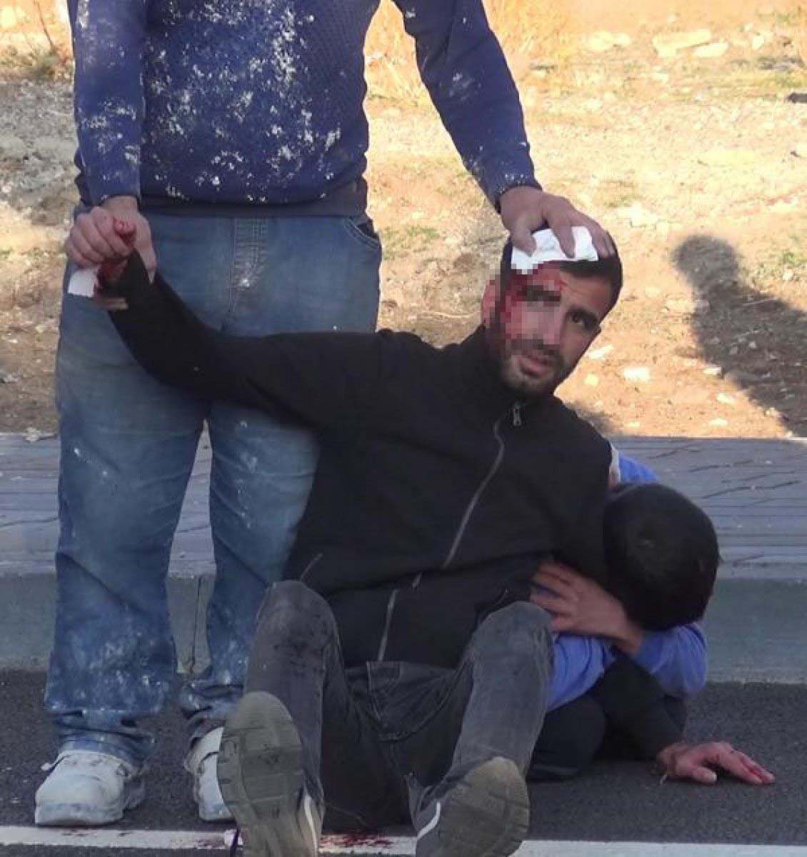 Erzurum Palandöken'de düğün öncesi kısır kavgası! Taş ve sopalar kullanıldı: 3 yaralı 