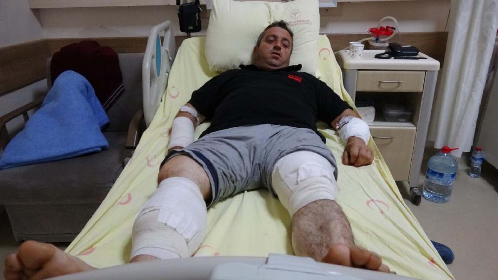 Tokat'ta ayı saldırısına uğrayan vatandaş canını zor kurtardı: Ben ayıya sarıldım güreş yaptık, kaldırıp atınca çekip gitti