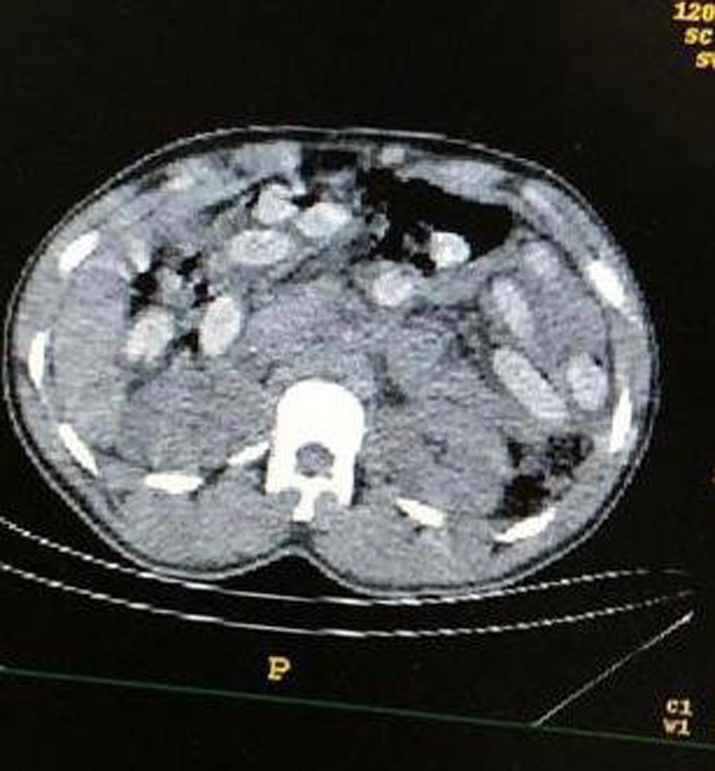 523,9 gram eroini mide ve bağırsaklarında taşıdılar! Uyuşturucu tacirleri otogarda yakalandı!