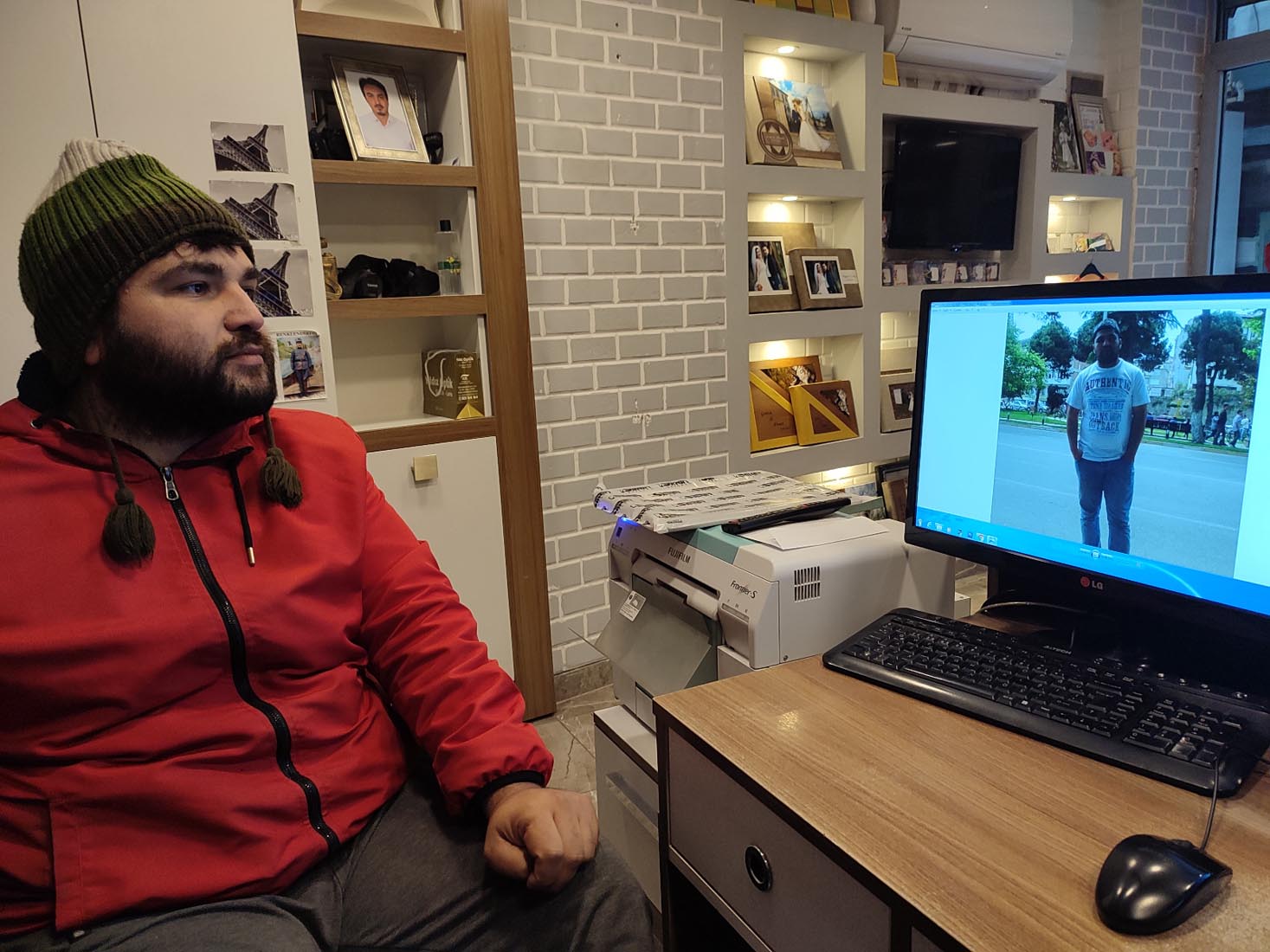 Ordu'dan Japonya'ya sağlam gitti, felç olup geldi! Göbeğindeki sivilceyi sıkan adam sadece 3 gün içinde felç kaldı!