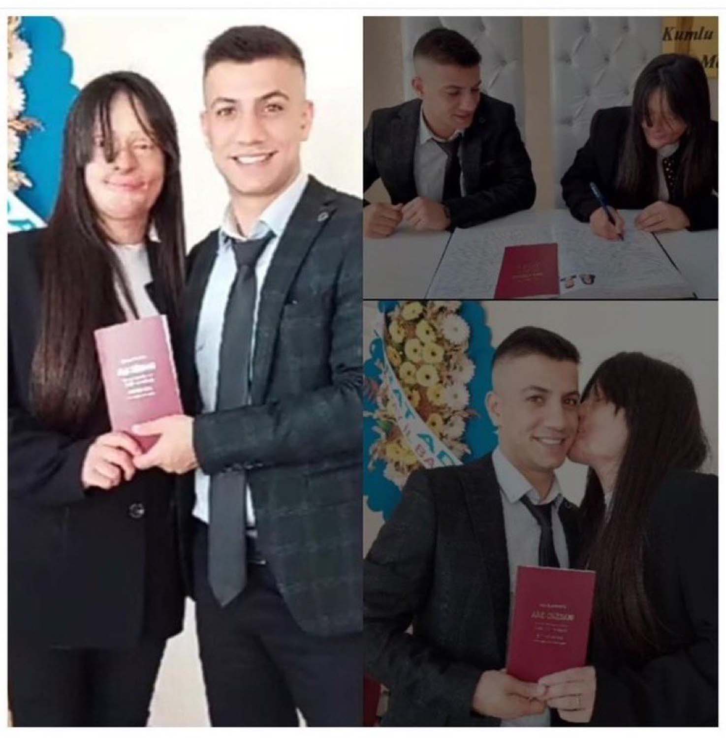 Celladına aşık olmak dedikleri! Berfin Özek, suratına kezzap atan sevgilisi Ozan Çeltik ile evlendi!