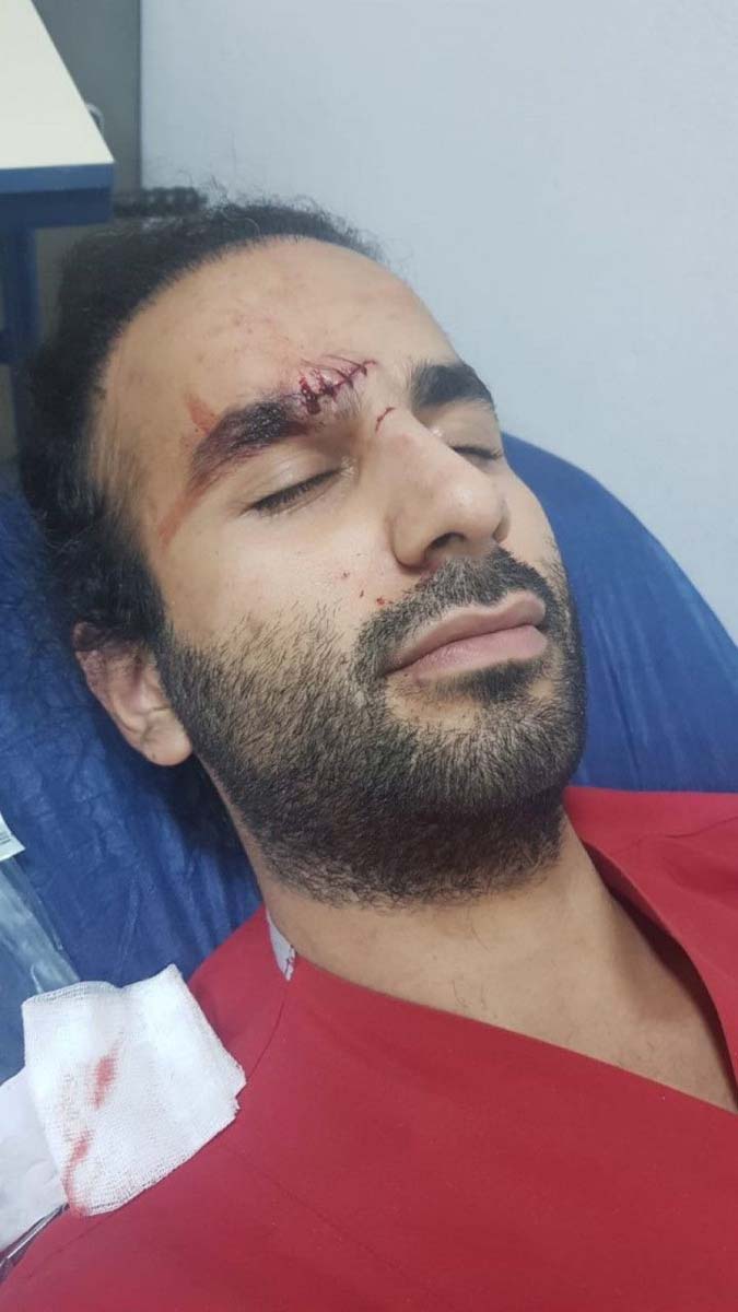 Bakan Koca tepki göstermişti! Didim Devlet Hastanesinde doktora kafa atan şahıs yeniden gözaltına alındı