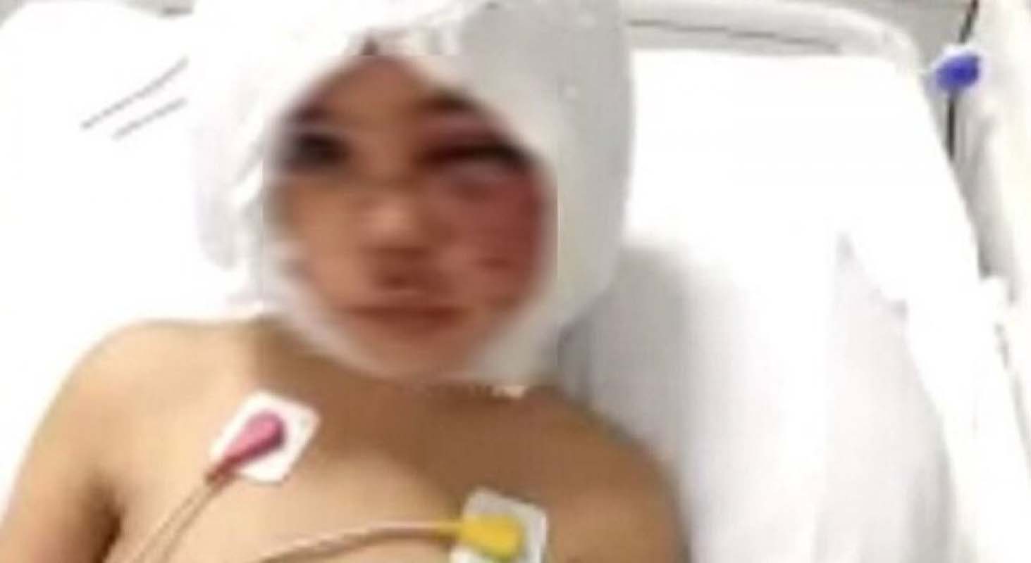 Pitbulllar tarafından korkunç saldırıya uğramıştı! Asiye Ateş'in ameliyat öncesi annesine sorduğu soru yürekleri parçaladı!