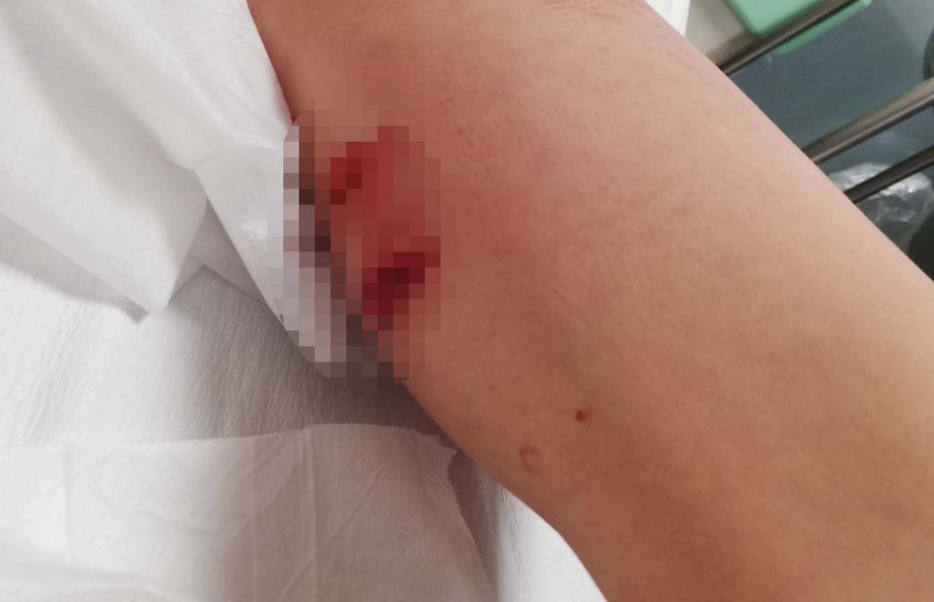 İzmir Buca'da pitbull dehşeti! Saldırıya uğrayan çocuğun psikolojisi bozuldu, sokağa dahi çıkamıyor!