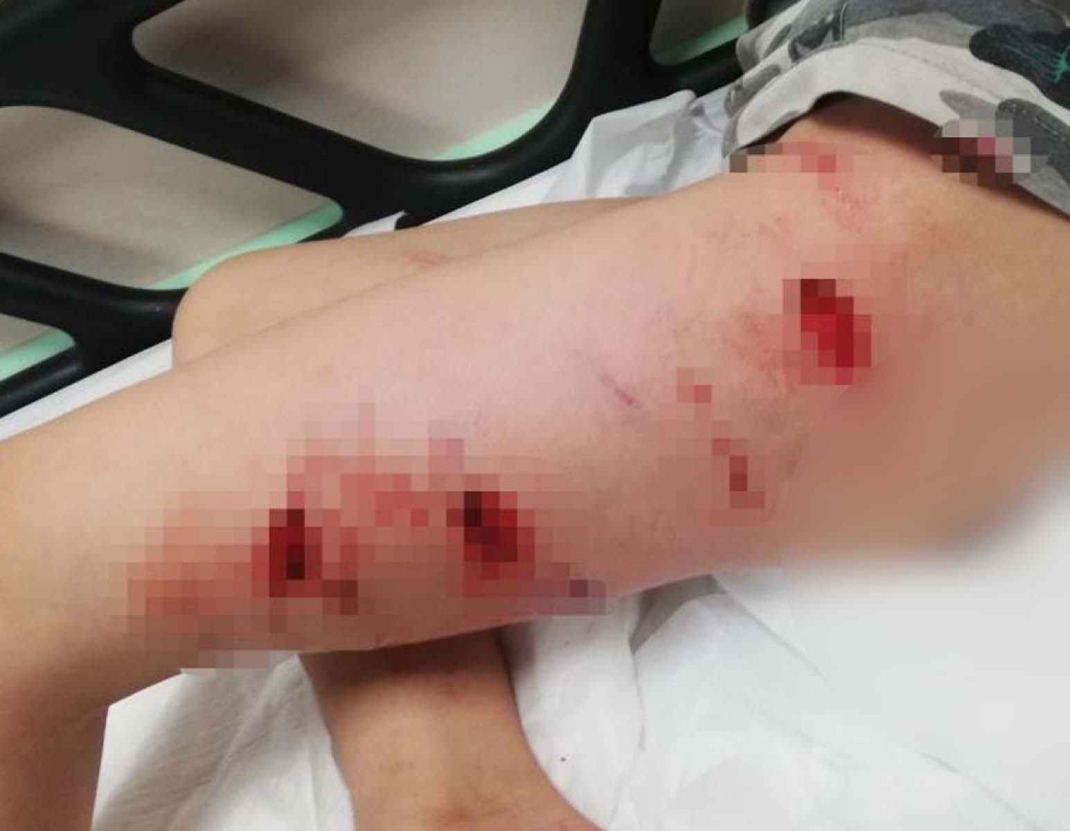 İzmir Buca'da pitbull dehşeti! Saldırıya uğrayan çocuğun psikolojisi bozuldu, sokağa dahi çıkamıyor!