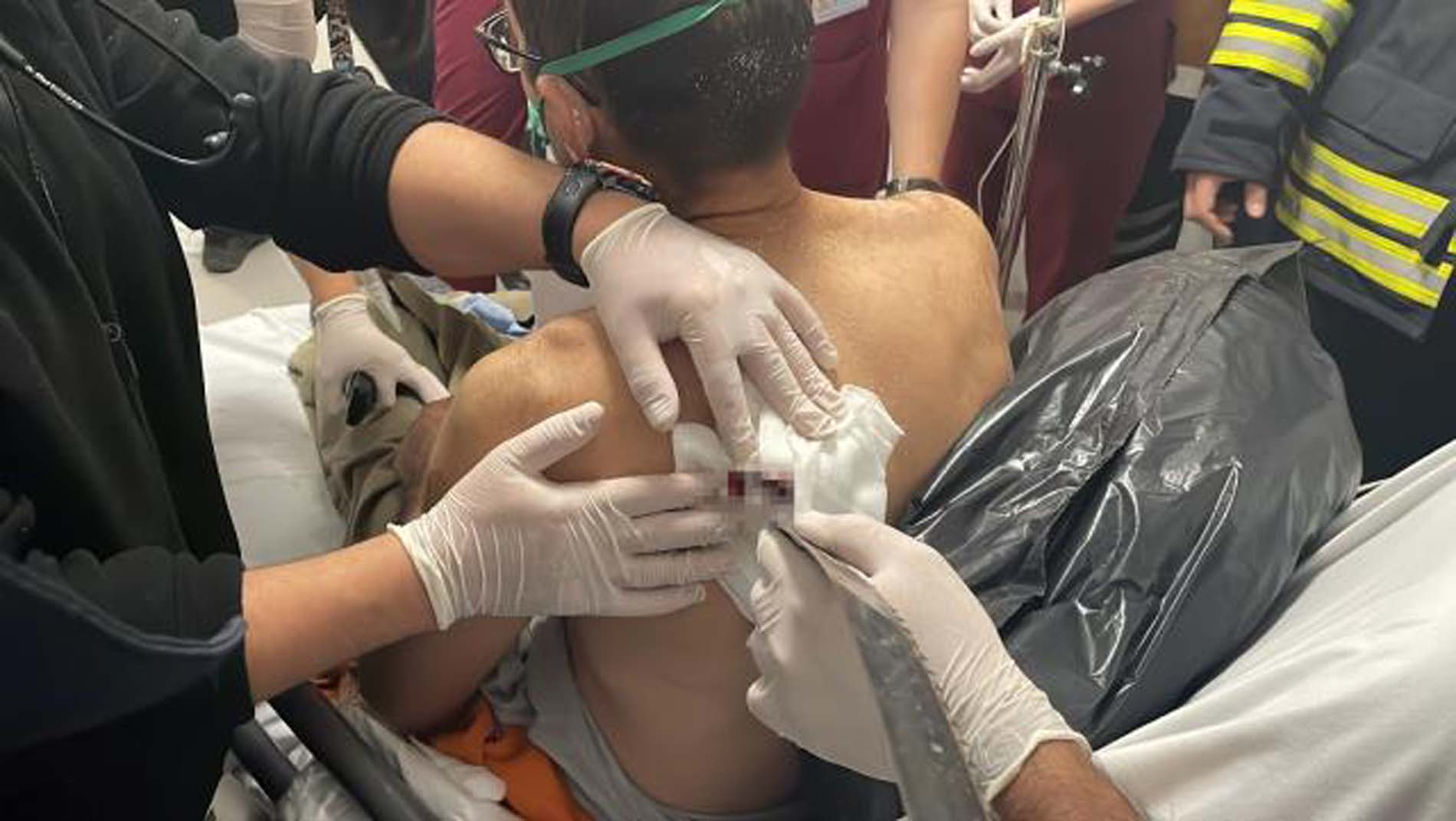 Sırtına testere saplandı! Operasyona itfaiye de katıldı! İşte o anlar...