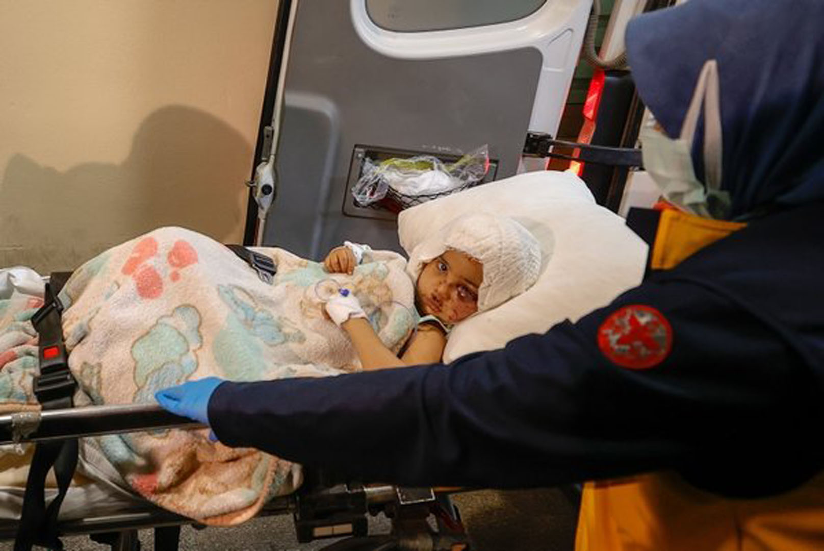 Pitbull saldırısına uğrayan minik Asiye'nin sağlık durumu belli oldu! Doktoru son durumunu açıkladı!