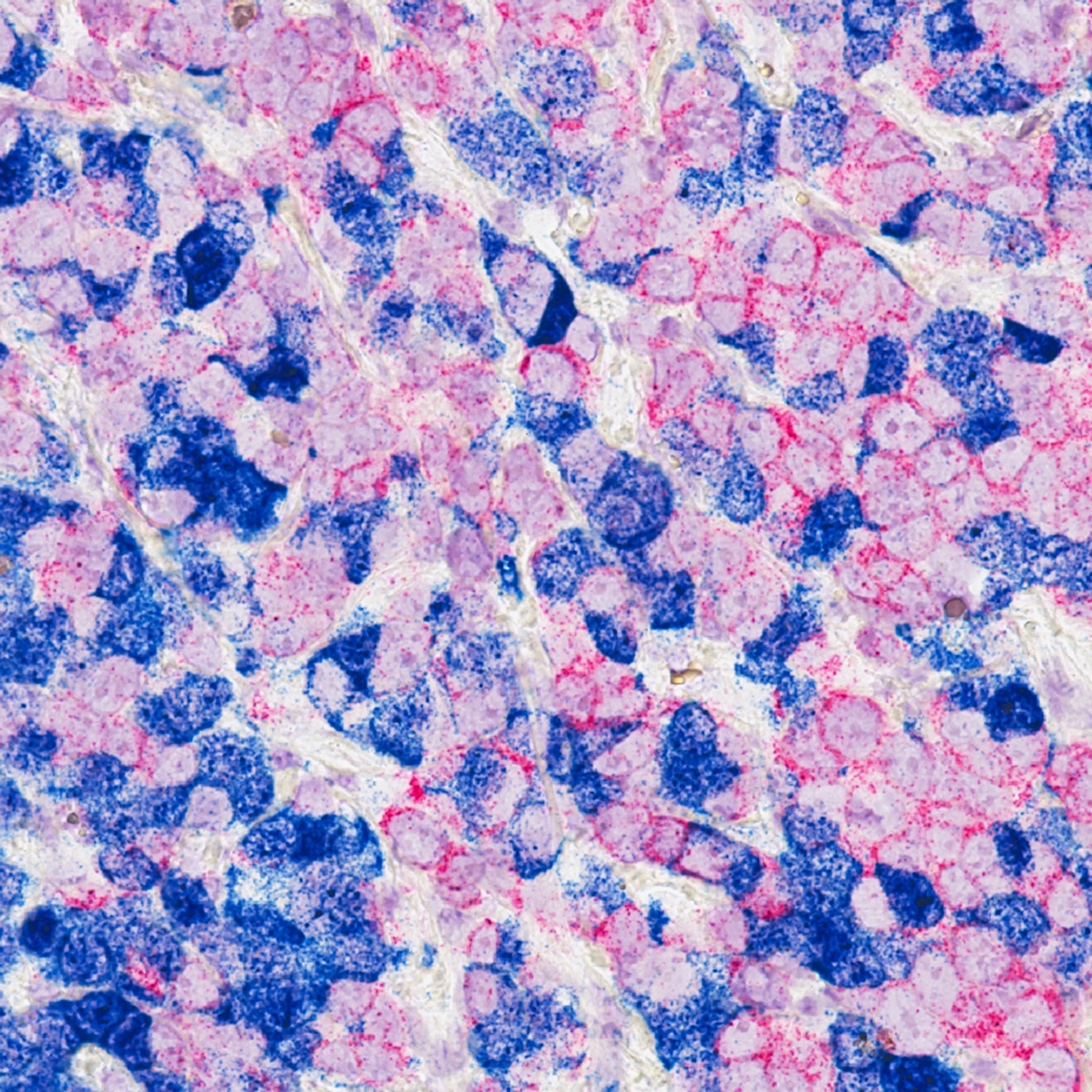 Kanser hastalarına devlet yardımı 2022