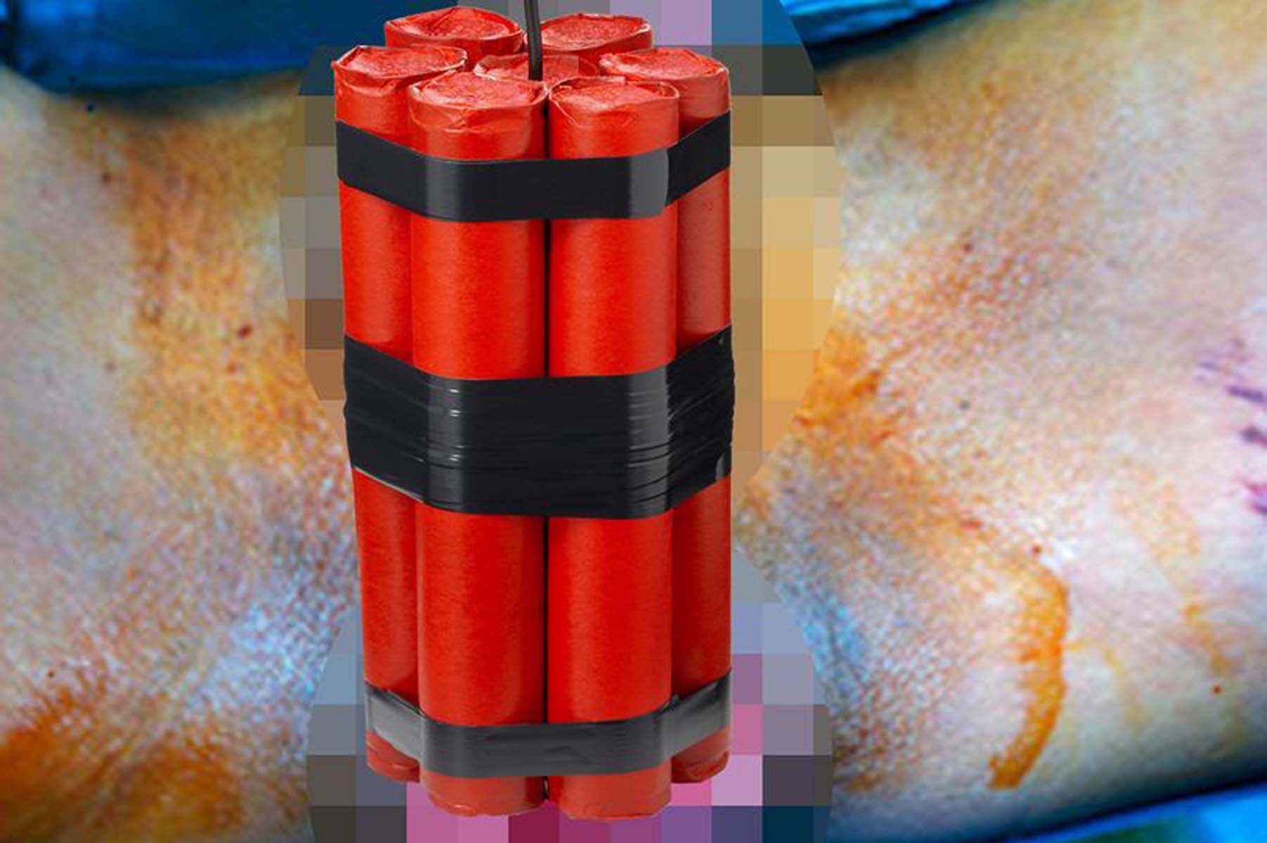 Tıp dergisine konu oldu! Denizli Pamukkale'de inanması güç olay: Poposuna dinamit benzeri cihaz koyup patlattı 