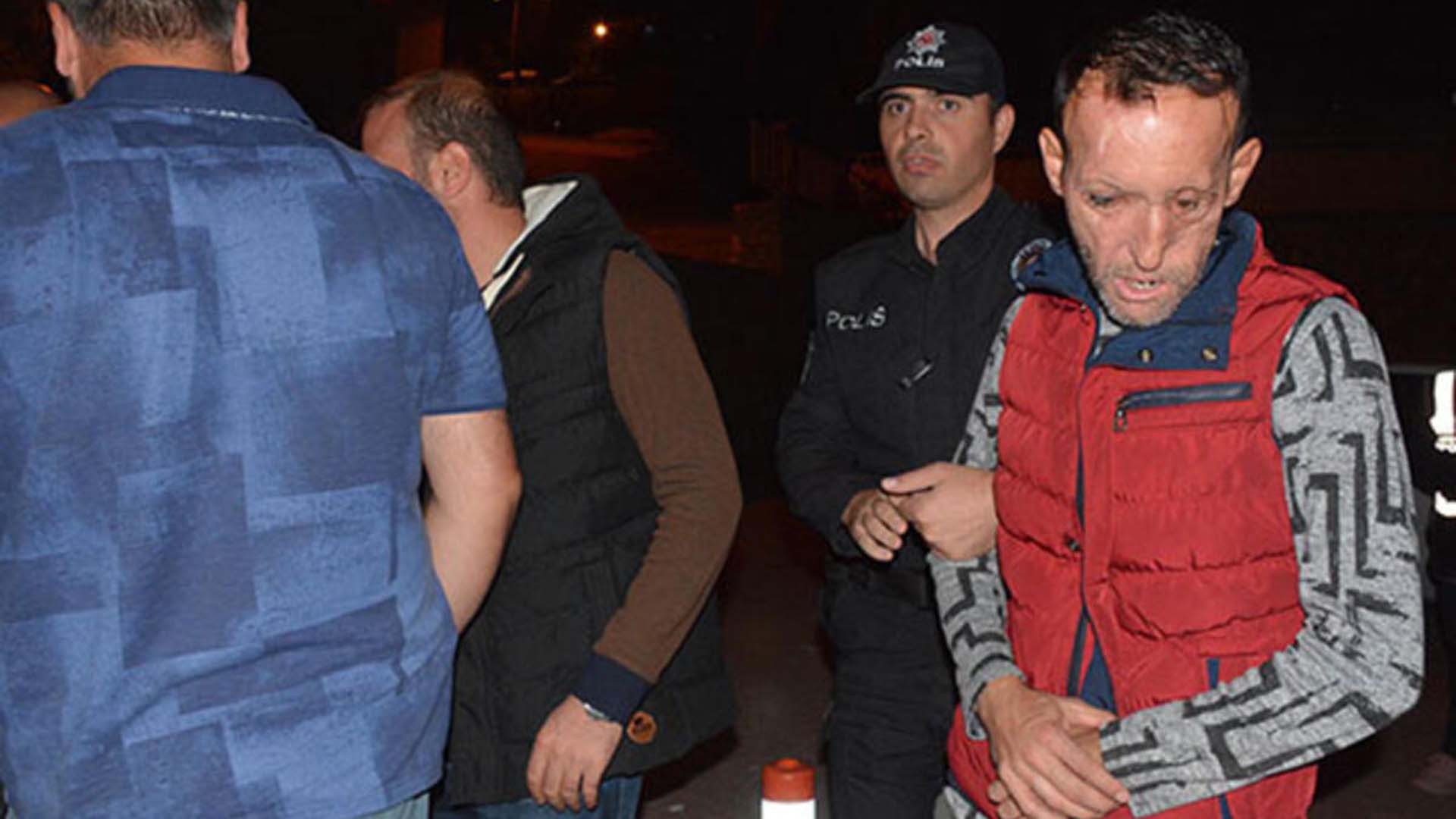 Türkiye’de ilk kez yüz nakli gerçekleştirilen Recep Sert gözaltına alındı! 