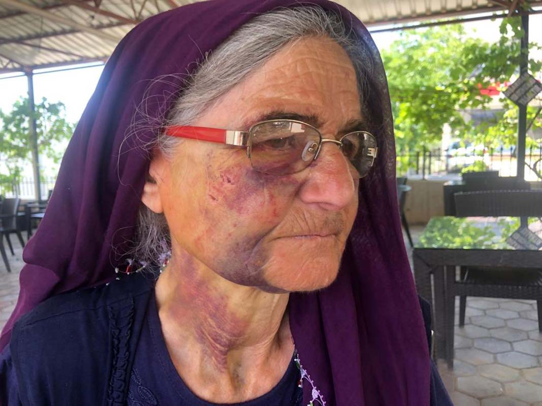 Adana, Kozan'da yaşlı kadını darp ettiği iddia edilen kişinin savunması pes dedirtti! Bana tükürürken...