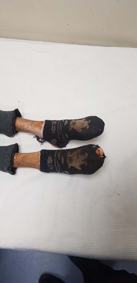 Türkiye bu olayı konuşuyor! Bursa'daki çöp evde bulunan Cem Muhammet'in sağlık durumu belli oldu! 