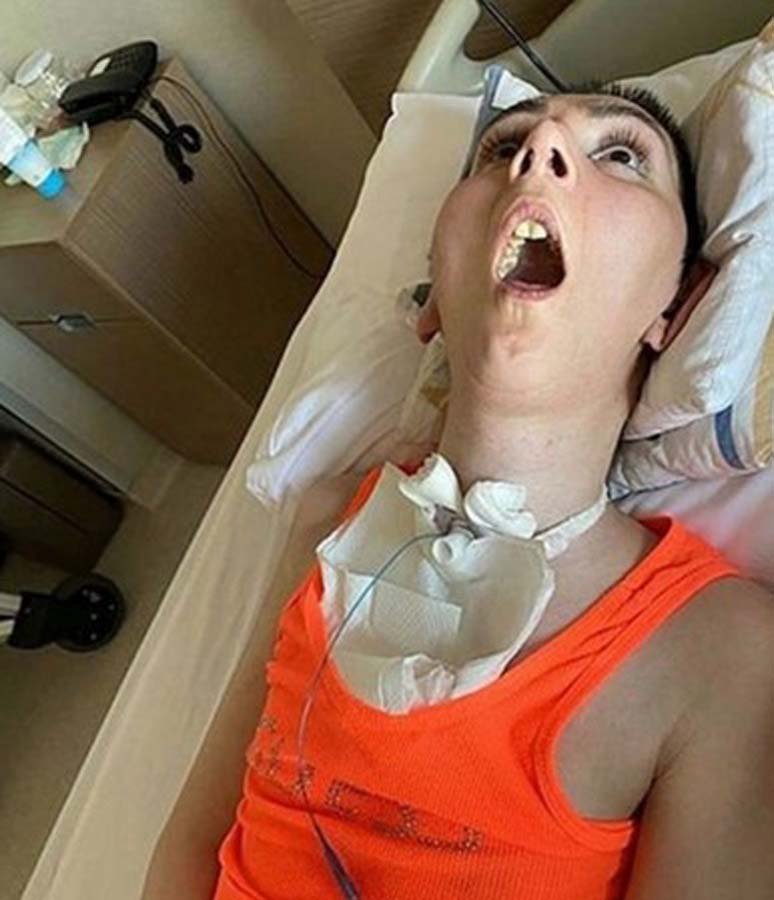 Estetik ameliyatı sonu oldu! Genç kadın hastaneden bitkisel hayata girmiş bir şeklide çıktı!