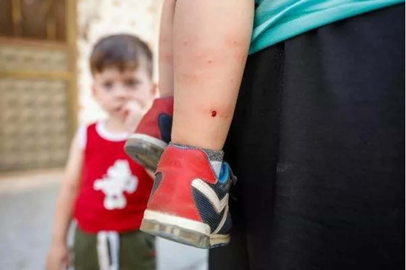İstanbul Aades türü sivrisinekler için alarma geçti! Uzman isim yeni çözümler için uyarılarda bulundu!