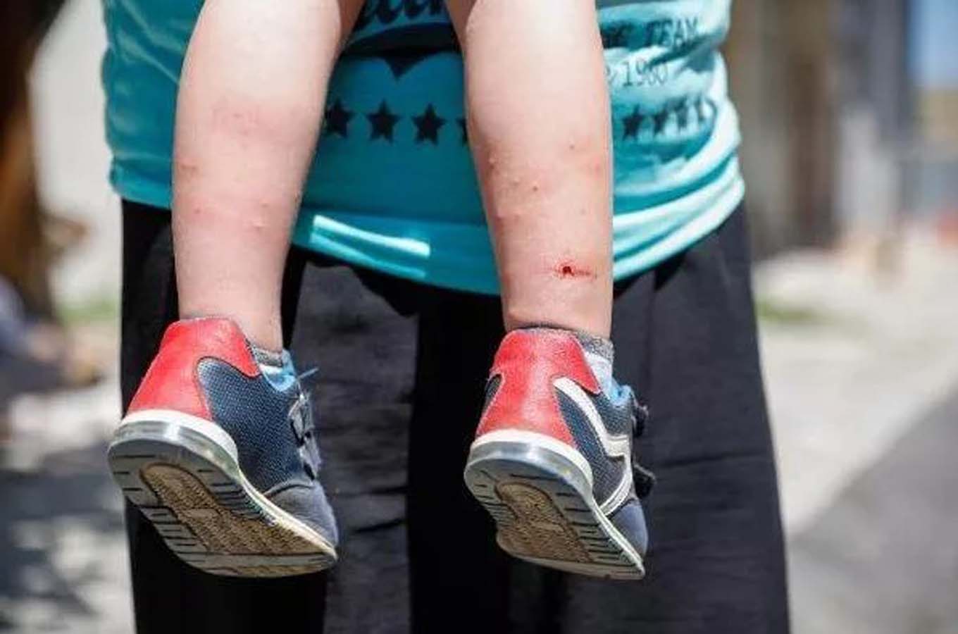 İstanbul Aades türü sivrisinekler için alarma geçti! Uzman isim yeni çözümler için uyarılarda bulundu!