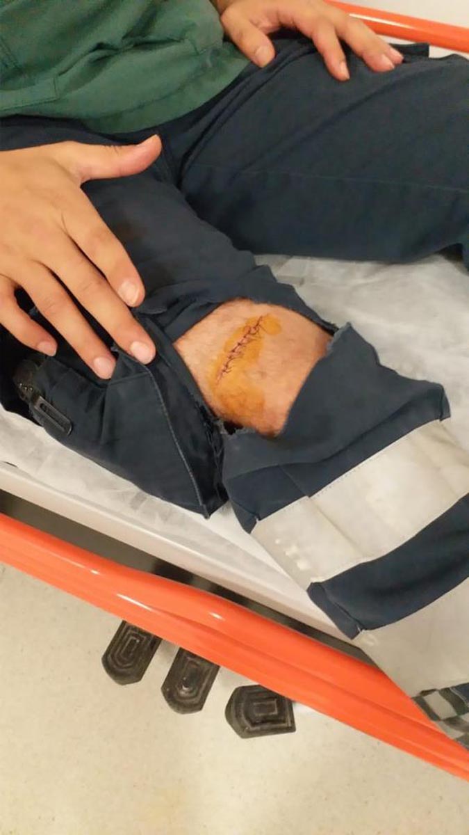 Sağlık çalışanına şiddet bitmek bilmiyor! Bu kez de makasla saldırdılar!