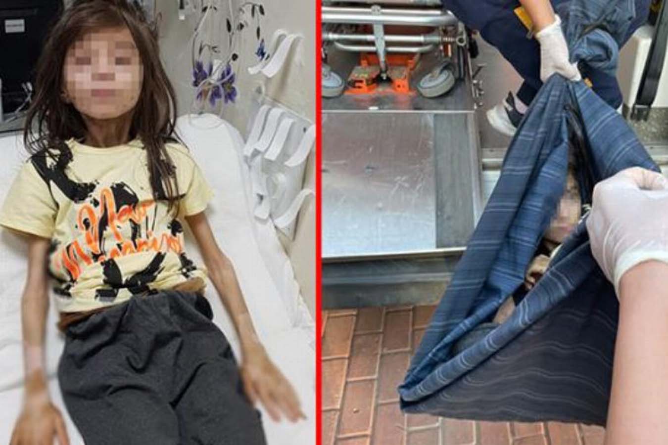 Bursa'daki çöp evde, bitkin bir şekilde bulunmuştu! Sağlık durumuna ilişkin açıklama geldi: Kilo alımı ve keyfi gayet iyi