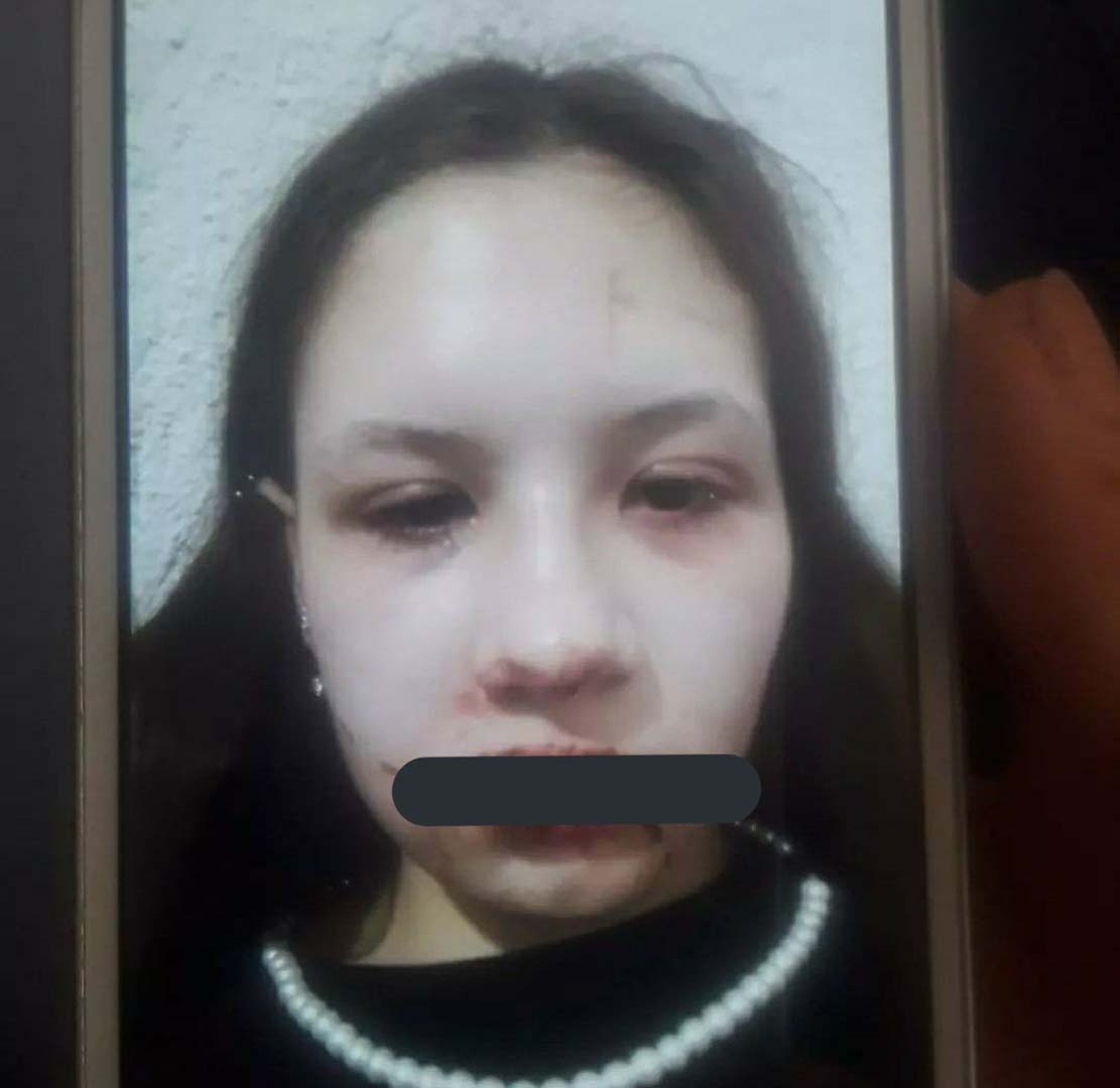 17 yaşındaki gencin yardım çığlıkları! Öz babasından şiddet gördüğünü bu hareketler ile gösterdi! Büyükelçilik harekete geçti!