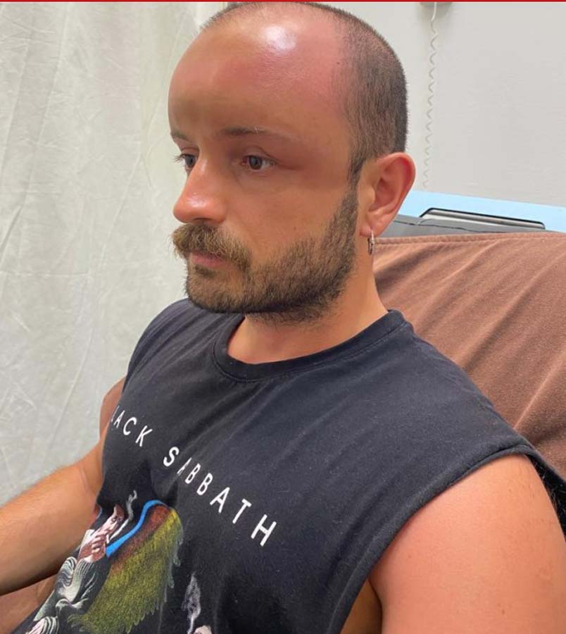 Zonguldak'ta bir garip vaka! Sıcak havada denize giren vatandaş nadir görülen bir rahatsızlığı yaşadı!