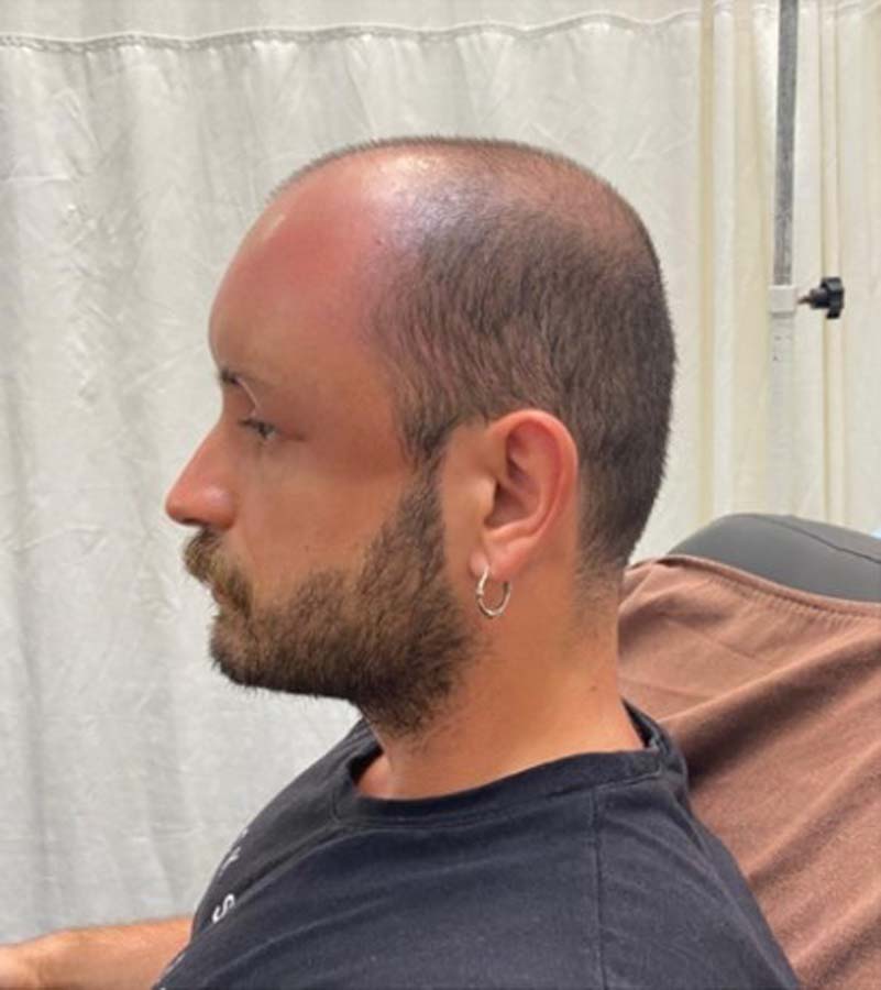 Zonguldak'ta bir garip vaka! Sıcak havada denize giren vatandaş nadir görülen bir rahatsızlığı yaşadı!