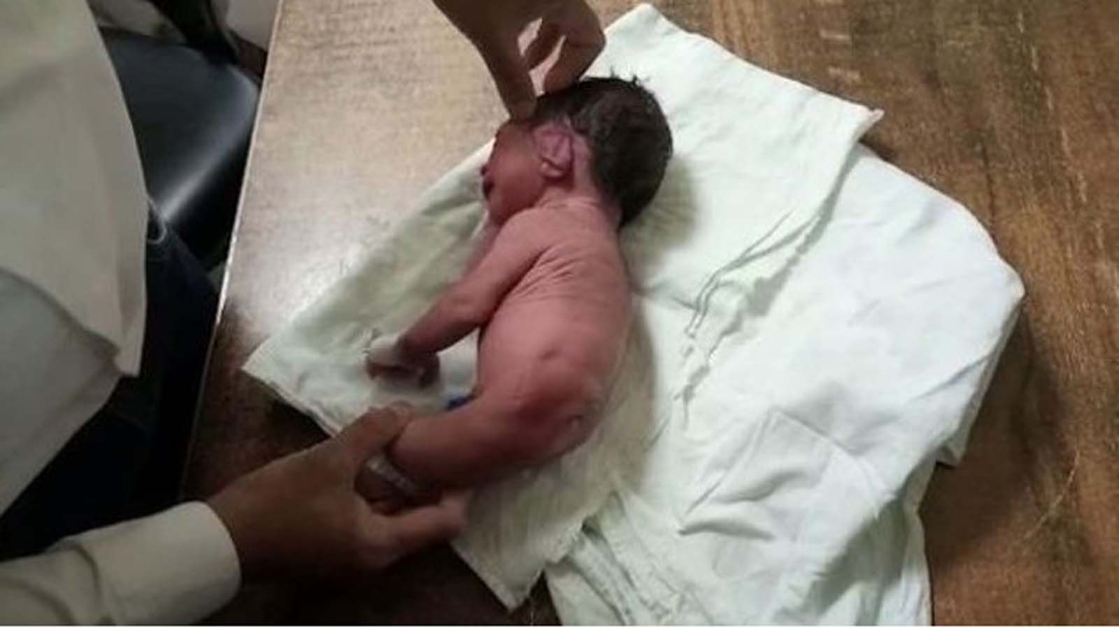 Doktorlar bebeğin belden aşağısını görünce şok oldu! Yeni doğan bebeğin bacakları yerine olan şey ağızları açık bıraktı!