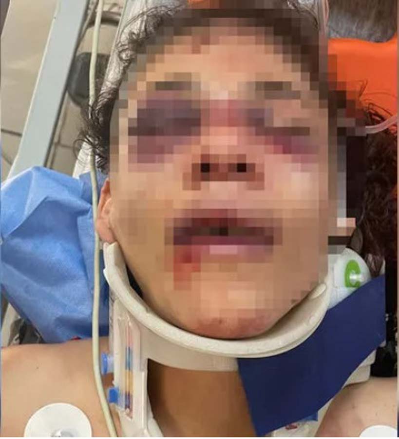 Cani koca dehşet saçtı! Tartıştığı eşini önce darp etti sonra 51 yerinden...