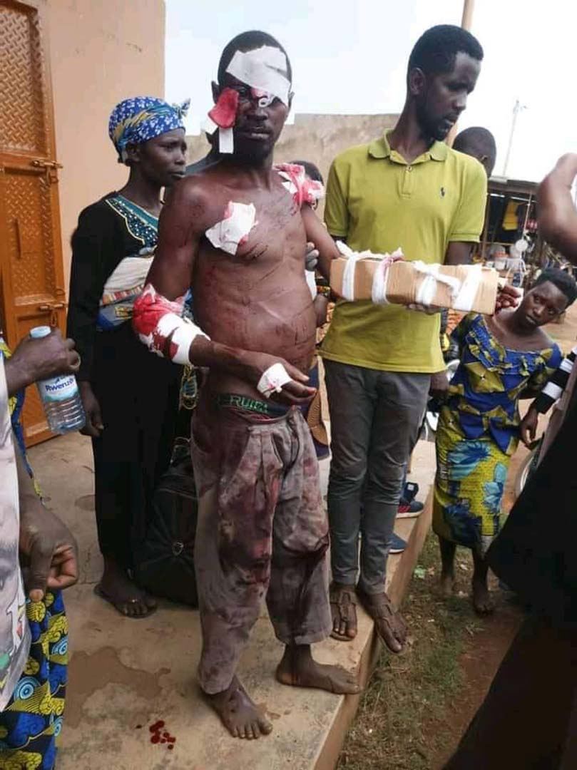 Karşılaştığı aslandan kaçmak yerine mücadele etmeyi tercih etti! Saatler sonra aslanı öldürdü, yaralı kolu karton ile sarıldı!