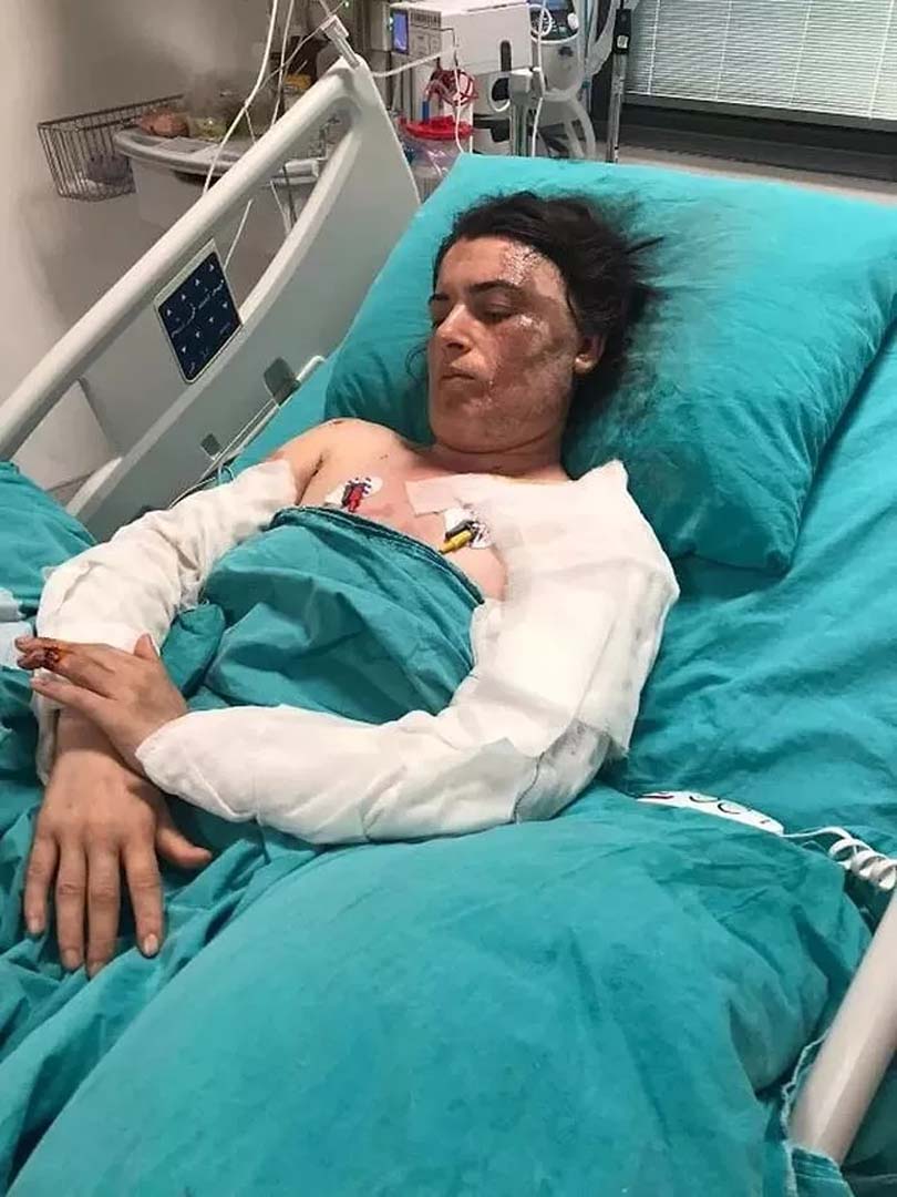 İstanbul'da eski elti dehşet yaşattı! 17 yerinden bıçakladı, vücuda kaynar su dökt ardından...