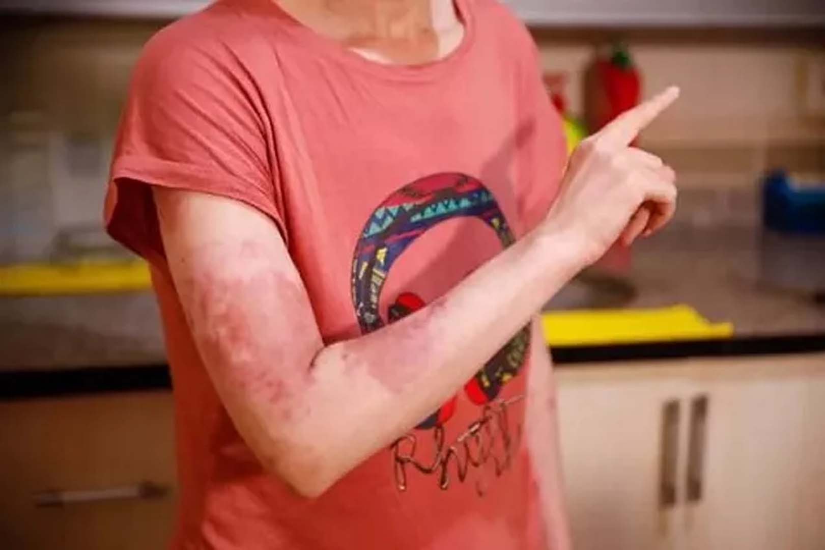 İstanbul'da eski elti dehşet yaşattı! 17 yerinden bıçakladı, vücuda kaynar su dökt ardından...