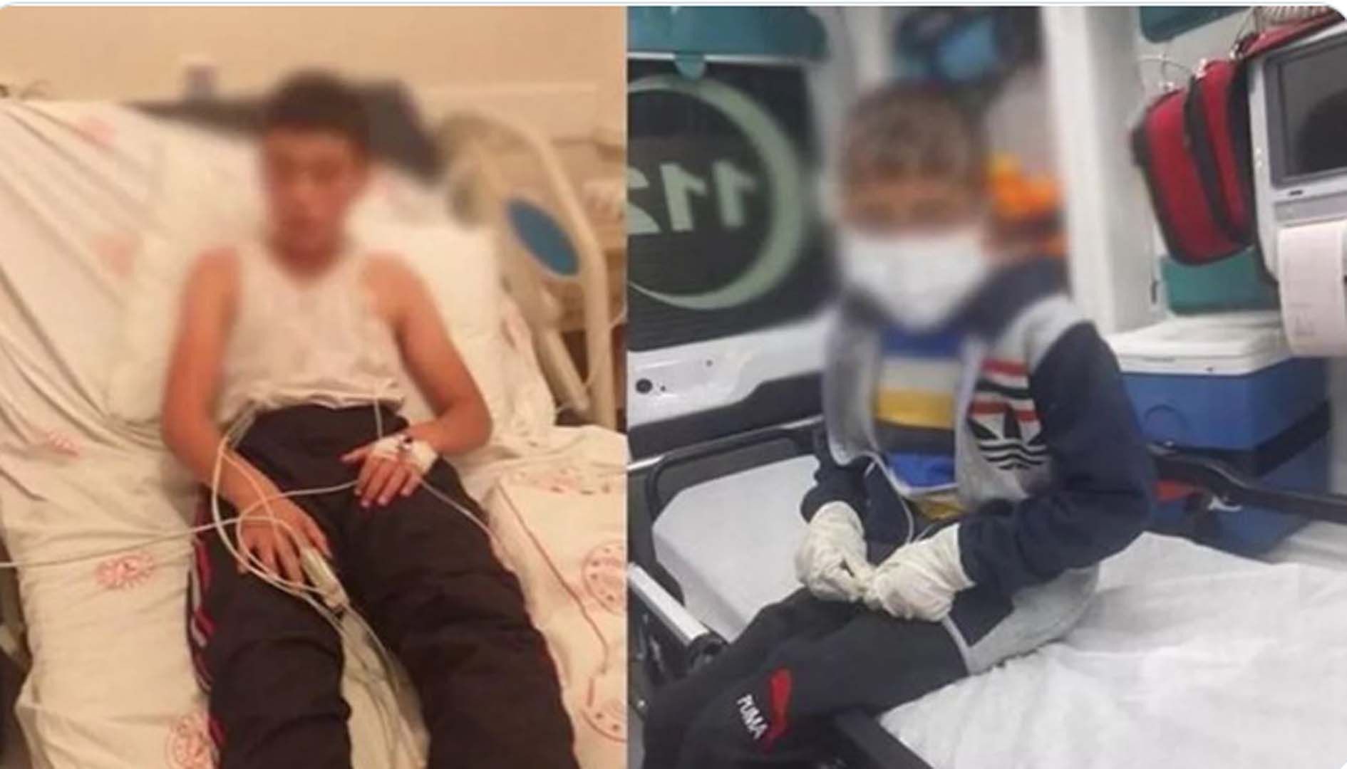 Sokak köpeği ısırdıktan sonra kuduz teşhisi koyulan çocuğun doktoru konuştu! Durumu çok kritik