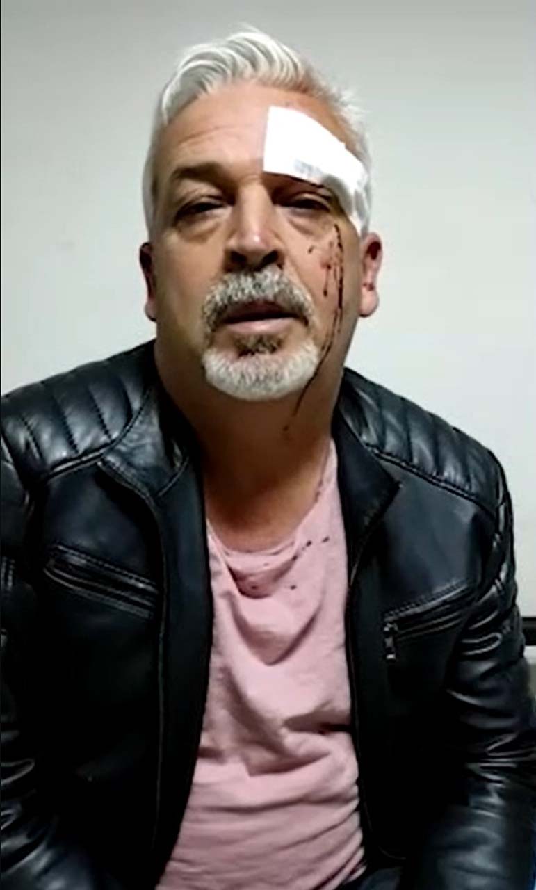 CHP'li belediye başkanının korumaları dehşet saçtı! Vatandaşa yapmadıklarını bırakmadılar