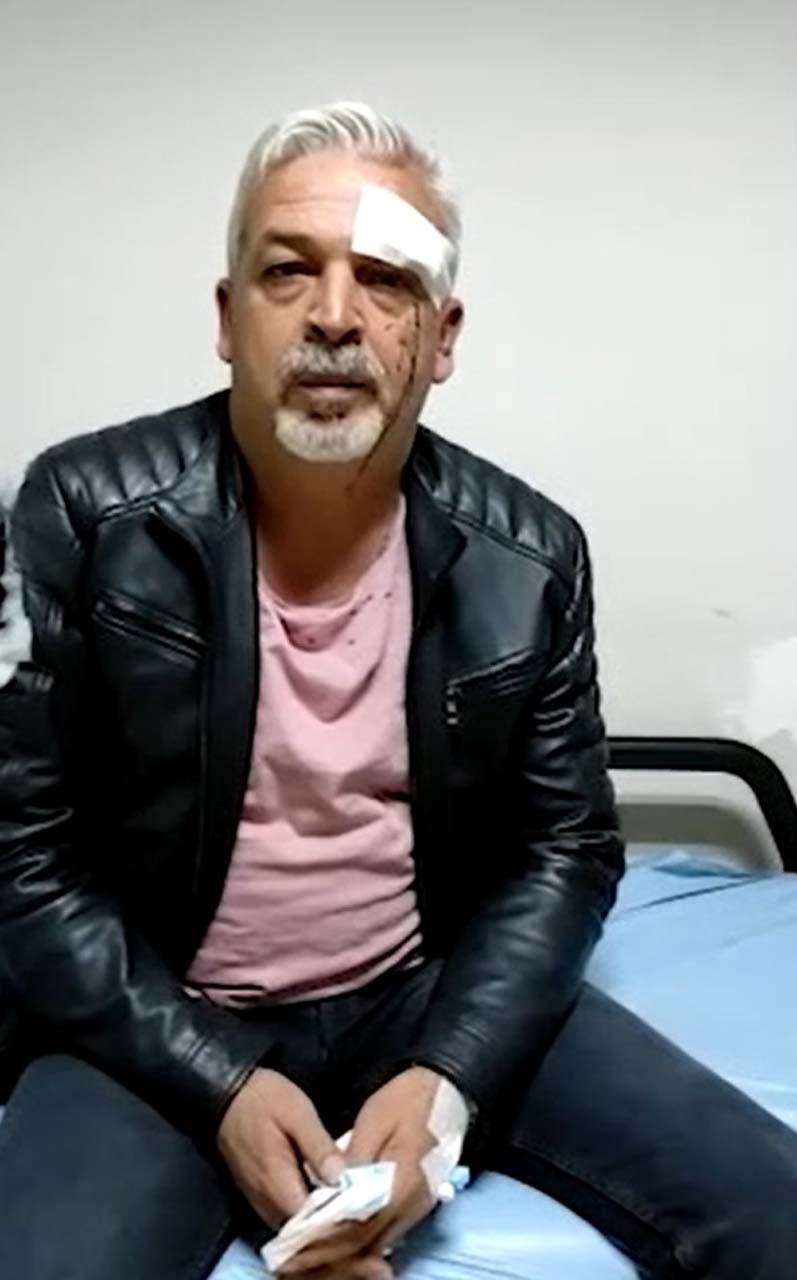 CHP'li belediye başkanının korumaları dehşet saçtı! Vatandaşa yapmadıklarını bırakmadılar