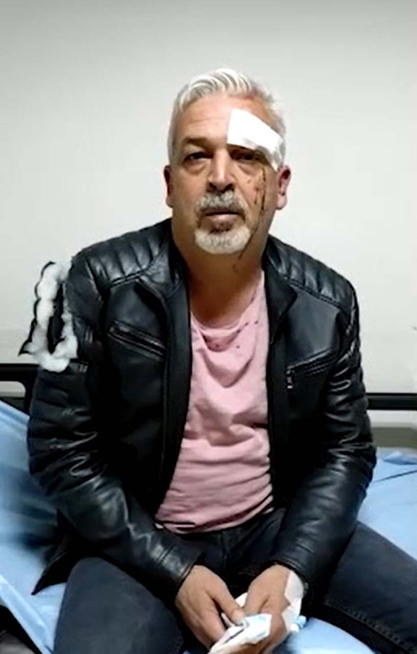 CHP'li belediye başkanının korumaları dehşet saçtı! Vatandaşa yapmadıklarını bırakmadılar