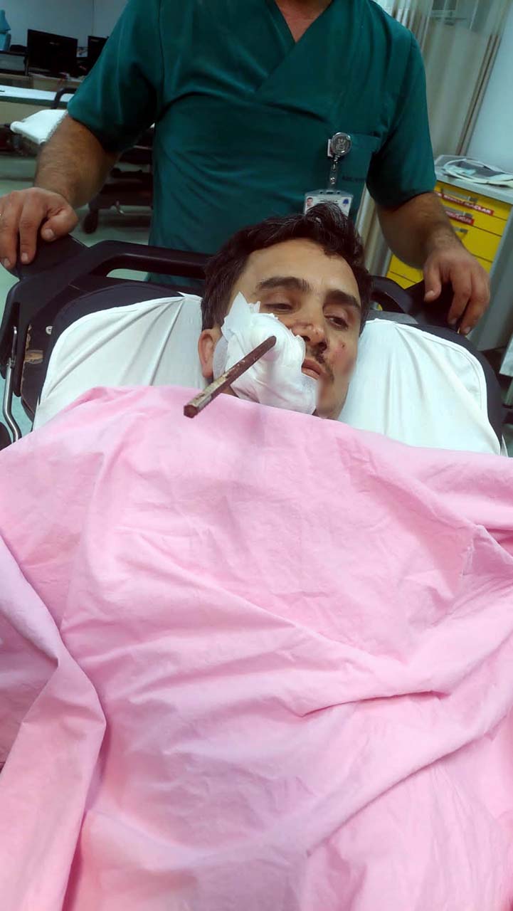 Giresun'da şoke eden olay! Yüzüne demir saplanan adam hastaneye kaldırıldı