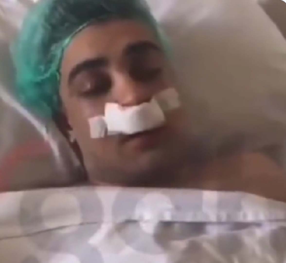 Narkozlu gencin güldüren halleri! Ağrısını unuttu altılı masanın Cumhurbaşkanı adayı hakkında konuştu!