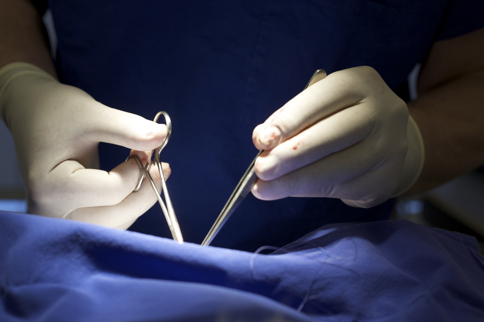 Karın şişliği ile hastaneye giden kadın hayatının şokunu yaşadı! Karnından öyle bir şey çıkartıldı ki, 110 kilodan 70 kiloya düştü!