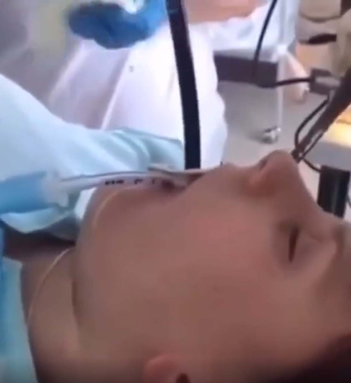 Anestezi doktoru paylaştı! Kadının ağzından çıkan şey şoke etti: Bunca yıllık Anestezistim ilk defa böyle vaka görüyorum.